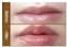 CE High Quality Hyaluronic Acid Injection Gel Dermal Filler for Lip Enhancement